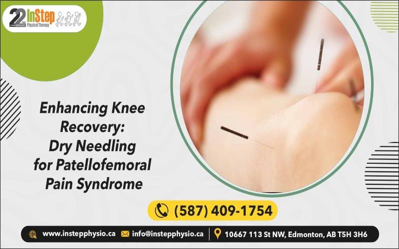 Enhancing-Knee-Recovery-Dry-Needling-for-Patellofemoral-Pain-Syndrome